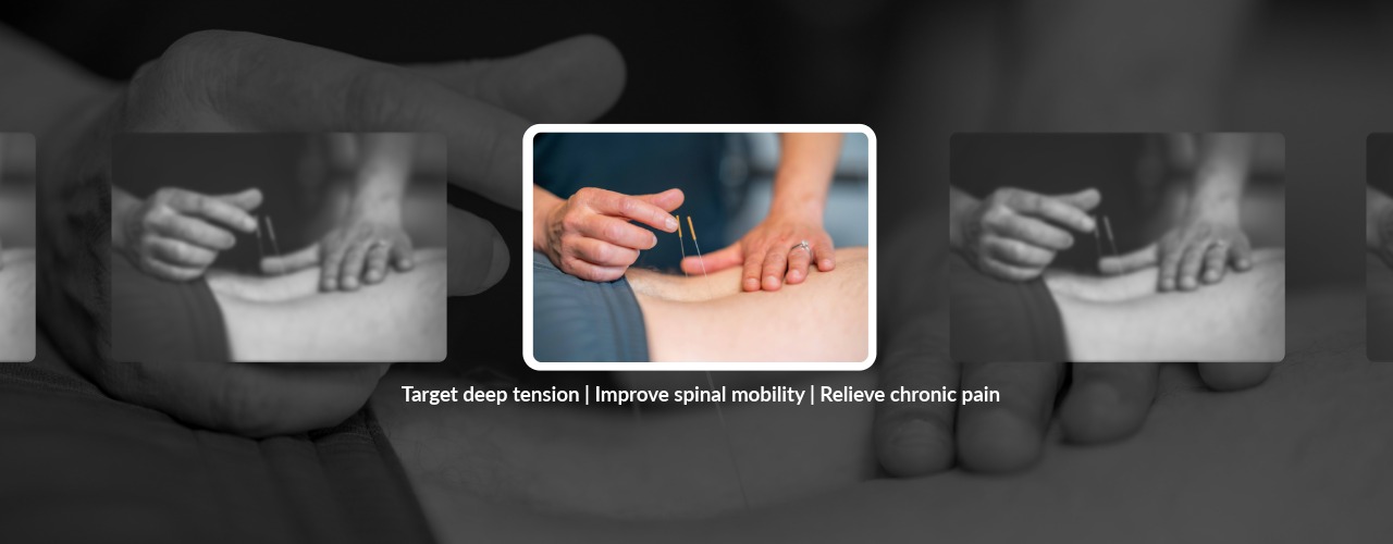 Beyond the Surface: How Dry Needling Tackles Back Pain